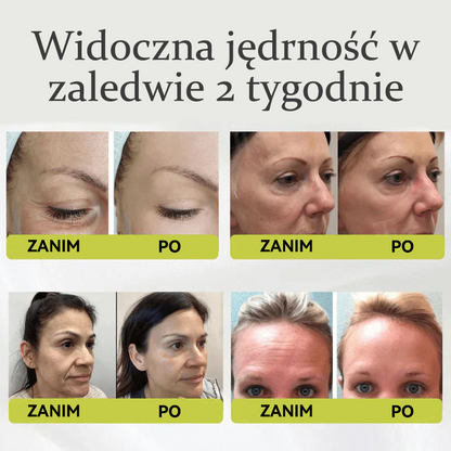 🎉👏🌿Dumnie opracowane i zatwierdzone przez polskie instytucje💫Tiworld® Zaawansowany krem liftingująco-odnawiający z peptydami o działaniu podobnym do botoksu + retinolem Vita-A – tylko dziś 70% zniżki