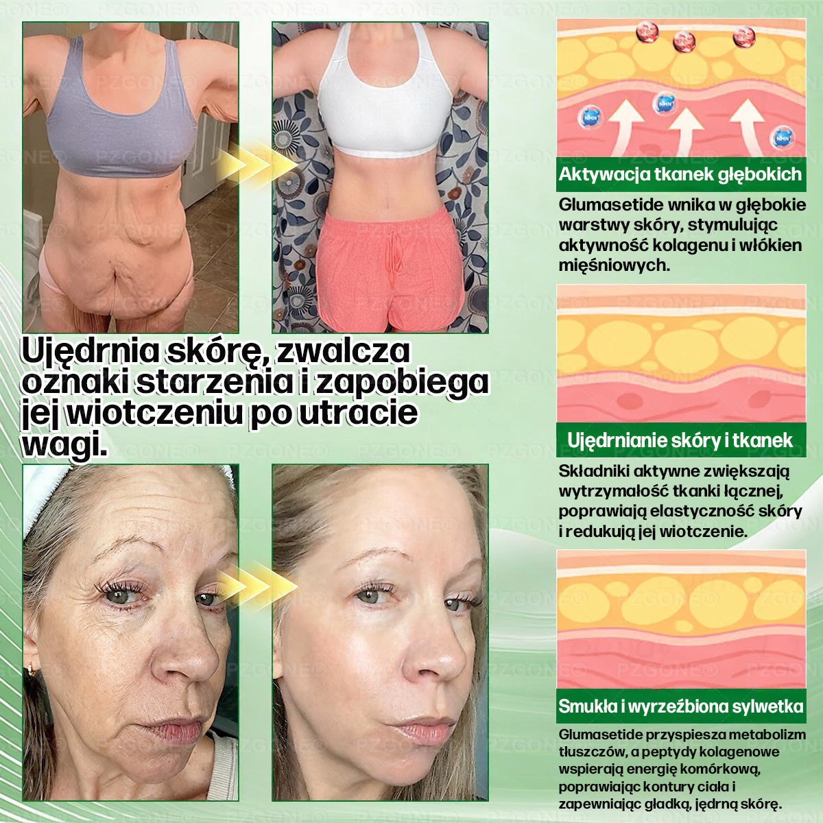 🎉🎉Oficjalny Sklep | 👩‍⚕️🎁 𝐏𝐙𝐆𝐎𝐍𝐄® Superfood 𝑵𝒂𝒏𝒐 Mikronakłuwana Plaster 🇵🇱(Tylko raz dziennie, widoczne zmiany już w 7 dni)✅ Na otyłość, 🅛🅞🅞🅢🅔 🅢🅚🅘🅝 wiotką skórę, cukrzycę, bezdech senny, problemy ze stawami i wiele więcej