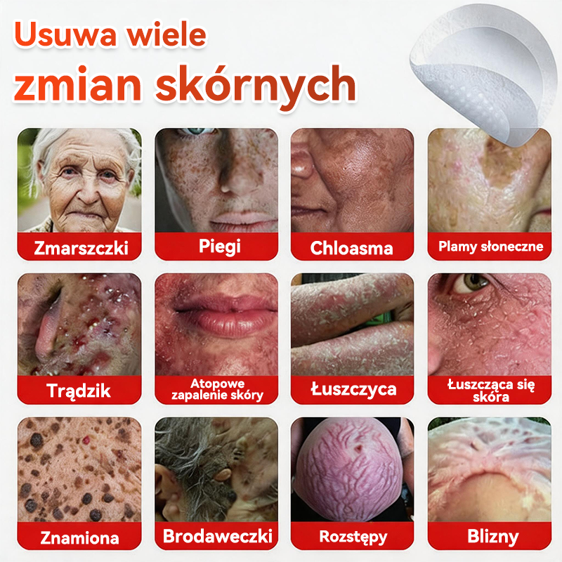 🎁 Zostało już tylko 5 opakowań! Teraz możesz otrzymać dodatkowe 50% ZNIŻKI!  Pomaga widocznie zmniejszyć włókniaki, brodawki i inne niedoskonałości skóry — szybko, wygodnie i bez bólu. 🌿