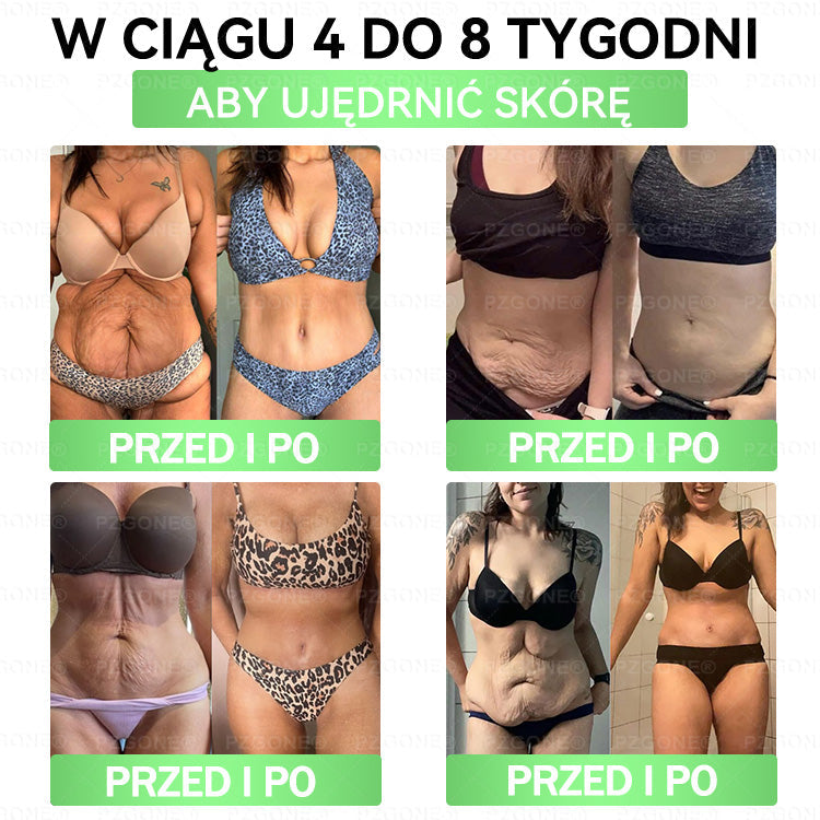 🎉🎉Oficjalny Sklep | 👩‍⚕️🎁 𝐏𝐙𝐆𝐎𝐍𝐄® Superfood 𝑵𝒂𝒏𝒐 Mikronakłuwana Plaster 🇵🇱(Tylko raz dziennie, widoczne zmiany już w 7 dni)✅ Na otyłość, 🅛🅞🅞🅢🅔 🅢🅚🅘🅝 wiotką skórę, cukrzycę, bezdech senny, problemy ze stawami i wiele więcej
