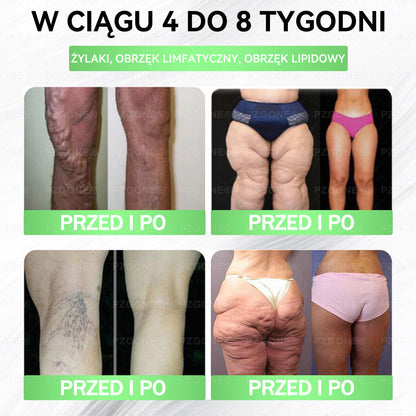 🎉🎉Oficjalny Sklep | 👩‍⚕️🎁 𝐏𝐙𝐆𝐎𝐍𝐄® Superfood 𝑵𝒂𝒏𝒐 Mikronakłuwana Plaster 🇵🇱(Tylko raz dziennie, widoczne zmiany już w 7 dni)✅ Na otyłość, 🅛🅞🅞🅢🅔 🅢🅚🅘🅝 wiotką skórę, cukrzycę, bezdech senny, problemy ze stawami i wiele więcej